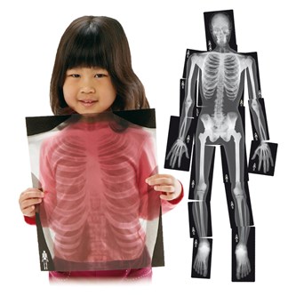 Røntgenbillede komplet menneske
