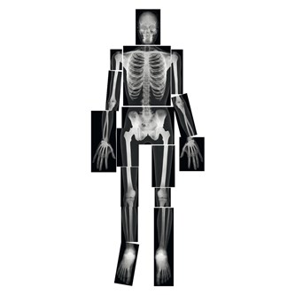 Røntgenbillede komplet menneske