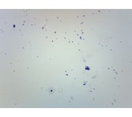 Streptokokker