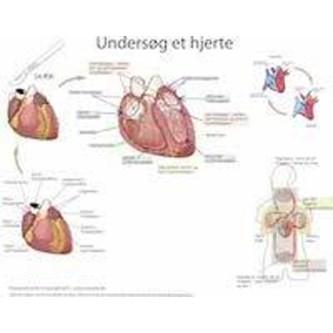 Dissektionsdug hjerte